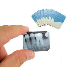 Dental X-ray Film