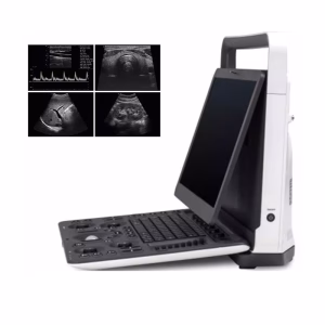 Sonoscape E1 Ultrasound