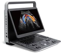 Sonoscape E2 Ultrasound